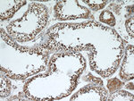 GATA4 Antibody in Immunohistochemistry (Paraffin) (IHC (P))