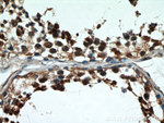 GATA4 Antibody in Immunohistochemistry (Paraffin) (IHC (P))