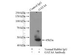 GATA4 Antibody in Immunoprecipitation (IP)