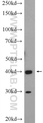 GATA4 Antibody in Western Blot (WB)