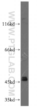 GATA4 Antibody in Western Blot (WB)