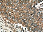 CDK1 Antibody in Immunohistochemistry (Paraffin) (IHC (P))