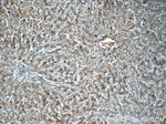 CHKA Antibody in Immunohistochemistry (Paraffin) (IHC (P))