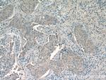 CHKA Antibody in Immunohistochemistry (Paraffin) (IHC (P))