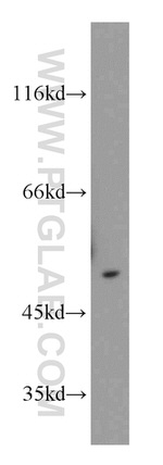 CHKA Antibody in Western Blot (WB)