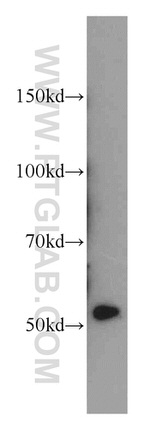 CHKA Antibody in Western Blot (WB)