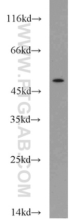 CHKA Antibody in Western Blot (WB)