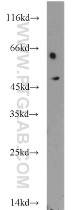 CHKA Antibody in Western Blot (WB)