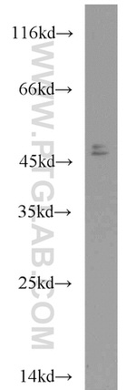 CHKA Antibody in Western Blot (WB)