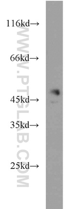 CHKA Antibody in Western Blot (WB)