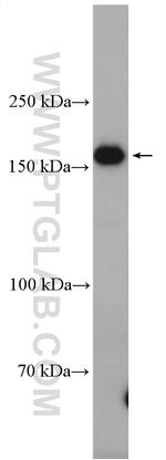 FANCA Antibody in Western Blot (WB)