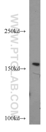 FANCA Antibody in Western Blot (WB)