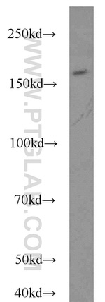 FANCA Antibody in Western Blot (WB)