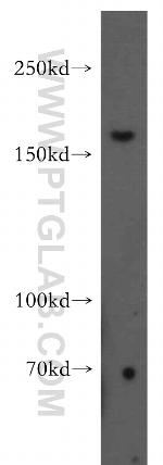 FANCA Antibody in Western Blot (WB)