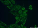 FEM1B Antibody in Immunocytochemistry (ICC/IF)