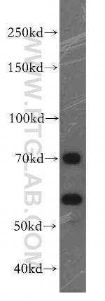 FEM1B Antibody in Western Blot (WB)