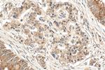 FEM1B Antibody in Immunohistochemistry (Paraffin) (IHC (P))