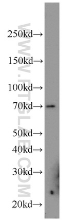 FEM1B Antibody in Western Blot (WB)