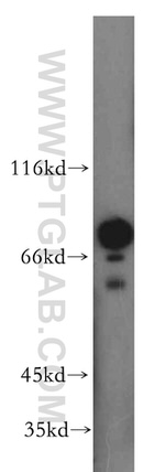FEM1B Antibody in Western Blot (WB)