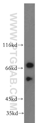 FEM1B Antibody in Western Blot (WB)