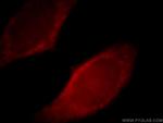 Myoferlin Antibody in Immunocytochemistry (ICC/IF)