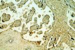 Myoferlin Antibody in Immunohistochemistry (Paraffin) (IHC (P))