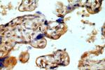 Myoferlin Antibody in Immunohistochemistry (Paraffin) (IHC (P))