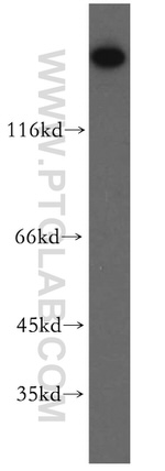 Myoferlin Antibody in Western Blot (WB)