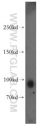 KIF19 Antibody in Western Blot (WB)