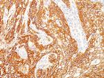 EGFRvIII (Epidermal Growth Factor Receptor, Variant III) Antibody in Immunohistochemistry (Paraffin) (IHC (P))