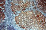 UBASH3B/STS 1 Antibody in Immunohistochemistry (Paraffin) (IHC (P))