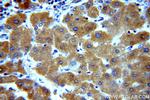 UBASH3B/STS 1 Antibody in Immunohistochemistry (Paraffin) (IHC (P))