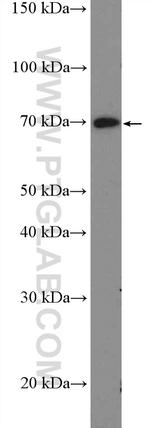 UBASH3B/STS 1 Antibody in Western Blot (WB)