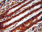 UNC45A Antibody in Immunohistochemistry (Paraffin) (IHC (P))