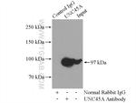 UNC45A Antibody in Immunoprecipitation (IP)