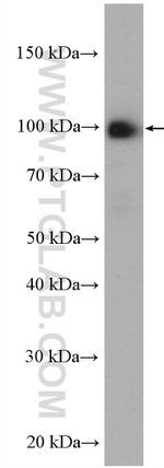 UNC45A Antibody in Western Blot (WB)