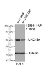 UNC45A Antibody in Western Blot (WB)