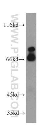 MCM-BP Antibody in Western Blot (WB)