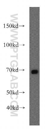 ENTPD4 Antibody in Western Blot (WB)