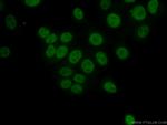 NAB2 Antibody in Immunocytochemistry (ICC/IF)