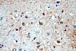 NAB2 Antibody in Immunohistochemistry (Paraffin) (IHC (P))