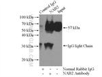 NAB2 Antibody in Immunoprecipitation (IP)