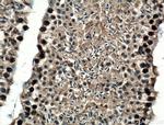 TRIP13 Antibody in Immunohistochemistry (Paraffin) (IHC (P))