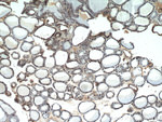 TRIP13 Antibody in Immunohistochemistry (Paraffin) (IHC (P))