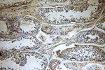 HYAL3 Antibody in Immunohistochemistry (Paraffin) (IHC (P))