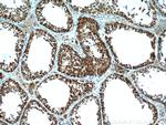 HYAL3 Antibody in Immunohistochemistry (Paraffin) (IHC (P))