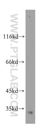 Histone H1.2 Antibody in Western Blot (WB)