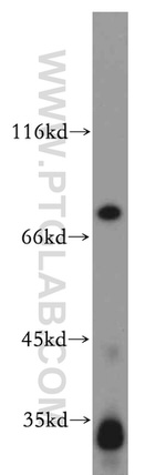 Histone H1.2 Antibody in Western Blot (WB)