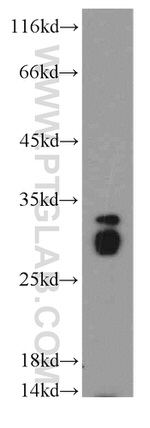 Histone H1.2 Antibody in Western Blot (WB)