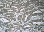 MUTYH Antibody in Immunohistochemistry (Paraffin) (IHC (P))